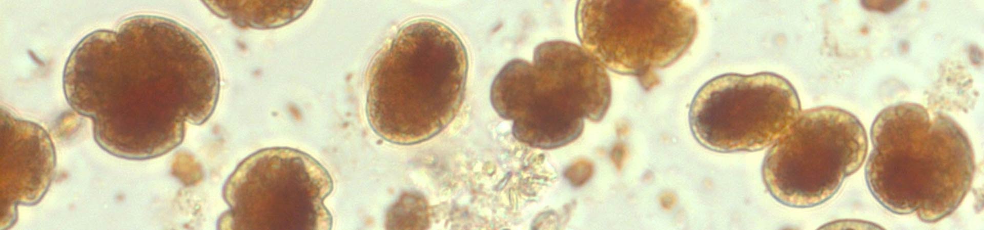 Microscopic image of harmful algal bloom phytoplankton