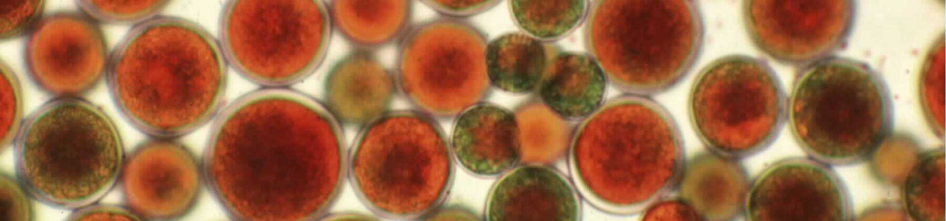 Microscope image of round red cells of the freshwater chlorophyte Haematococcus pluvialis