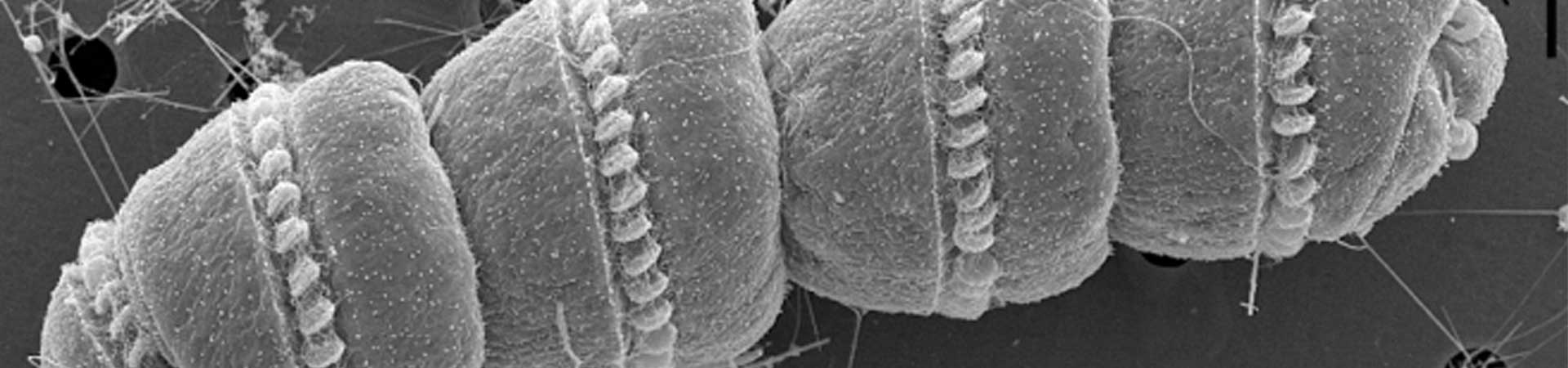 Electron microscope image of the toxic alga Cochlodinium polykrikoides. Culture established by M. Iwataki, sample from Tsushima Island, Nagasaki. Author Gert Hansen. Creative Commons license