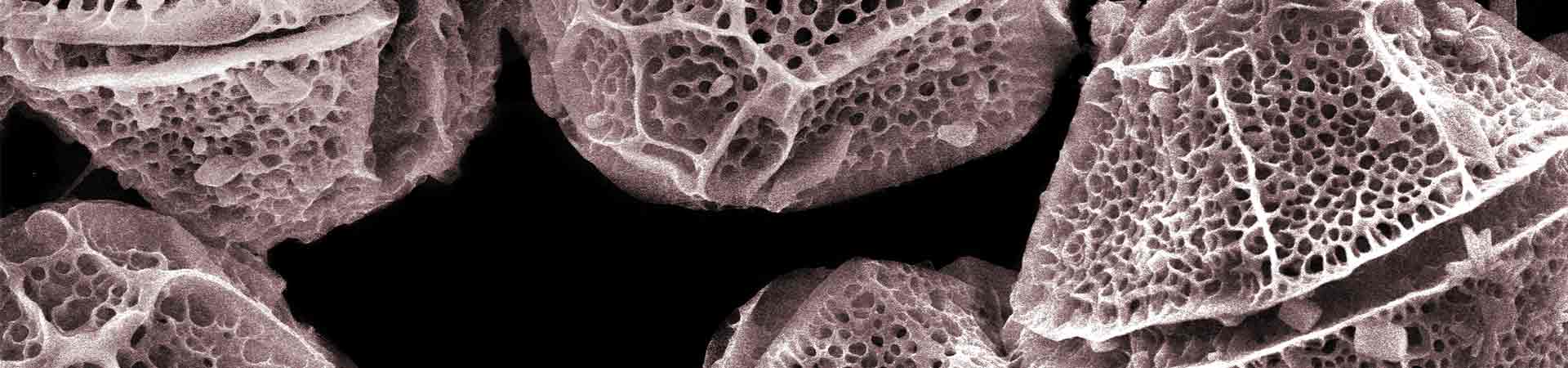 Electron microscope image of dinoflagellates that can produce shellfish toxins
