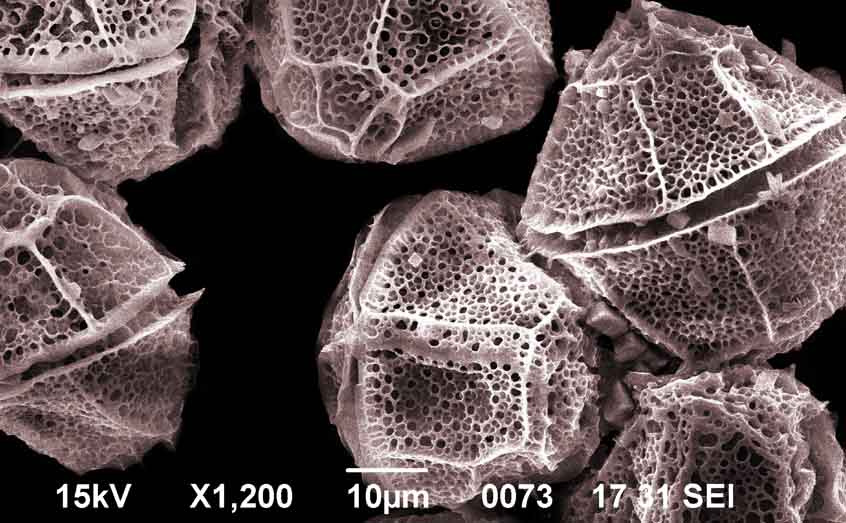 A scanning electron microscope image of the dinoflagellate Lingulodinium polyedra. Photo: Callum Whyte, SAMS